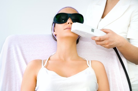 laser hair removal