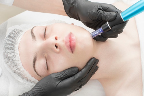 microneedling Linden NJ
